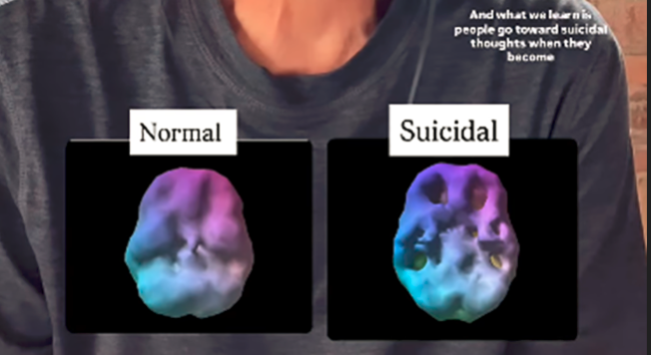 Kondisi otak normal dan otak yang berniat bunuh diri/Foto: tangkap layar video Instagram Dr Daniel Amen